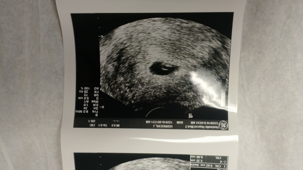 IMG_20161229_085020514