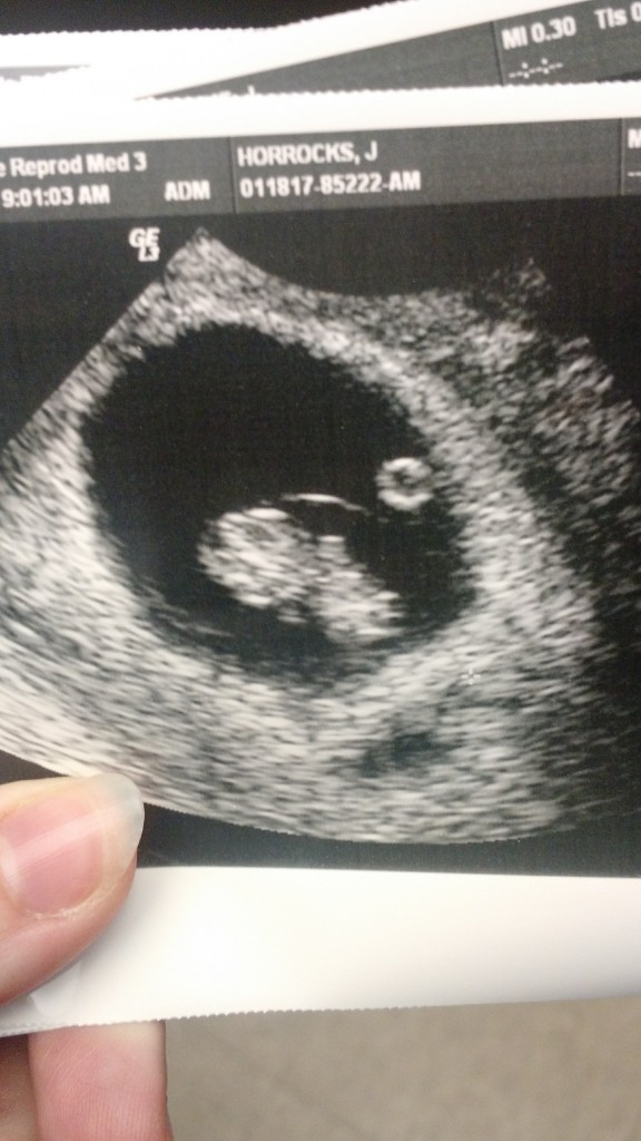 IMG_20170118_091639937